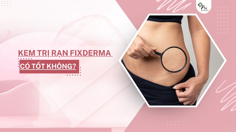 Kem Trị Rạn Fixderma Có Tốt Không?