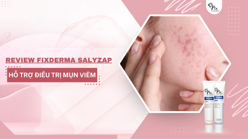 Review Fixderma Salyzap Hỗ Trợ Điều Trị Mụn Viêm Hiệu Quả An Toàn