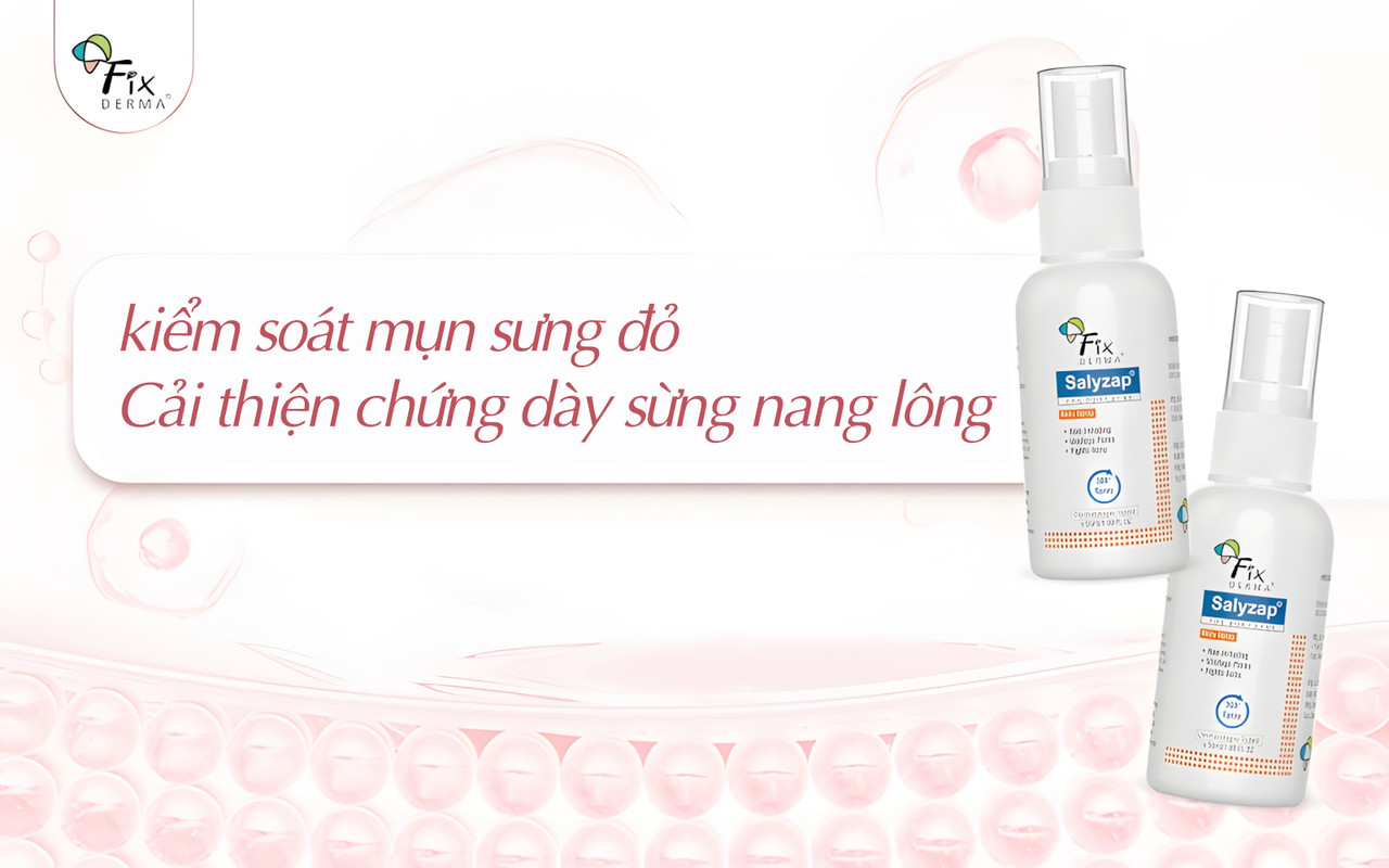 Kiểm soát mụn sưng viêm và dày sừng nang lông