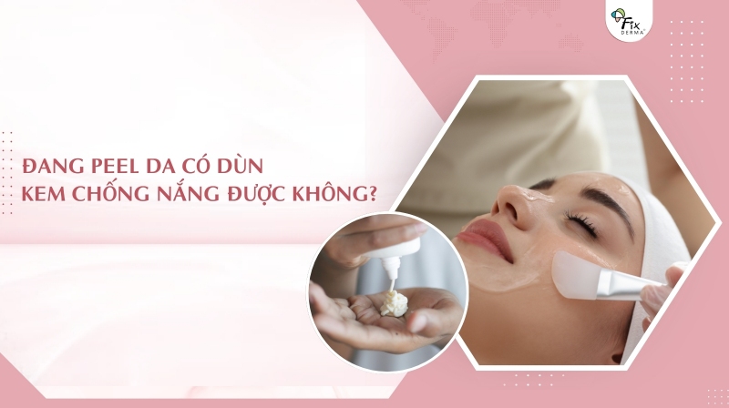 đang peel da có dùng kem chống nắng được không