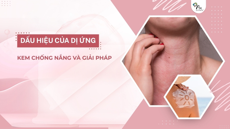 dị ứng kem chống nắng