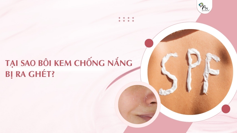tại sao bôi kem chống nắng bị ra ghét