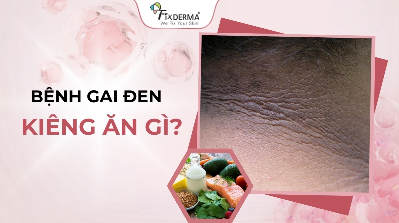 bệnh gai đen kiêng ăn gì