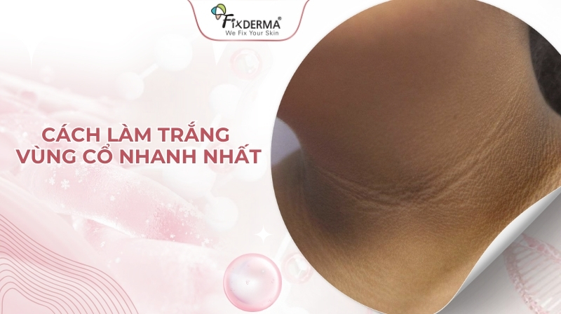 cách làm trắng cổ nhanh nhất