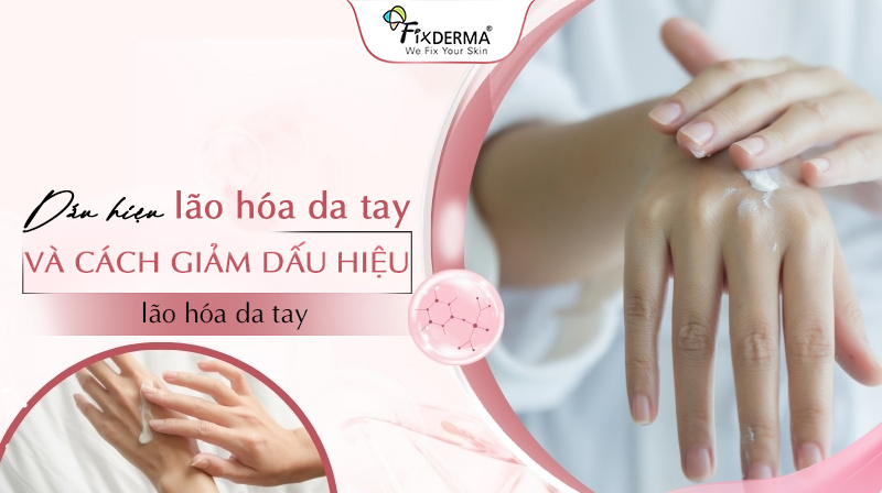 Dấu hiệu lão hóa da tay và cách giảm