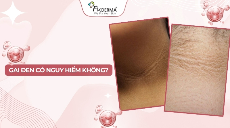 Gai đen có nguy hiểm không