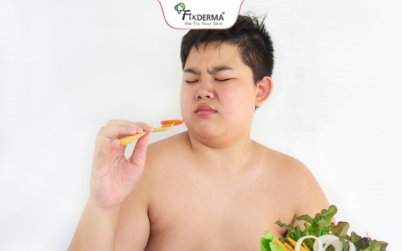 Gai đen do thừa cân, béo phì