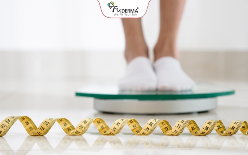 Giảm cân để cải thiện gai đen