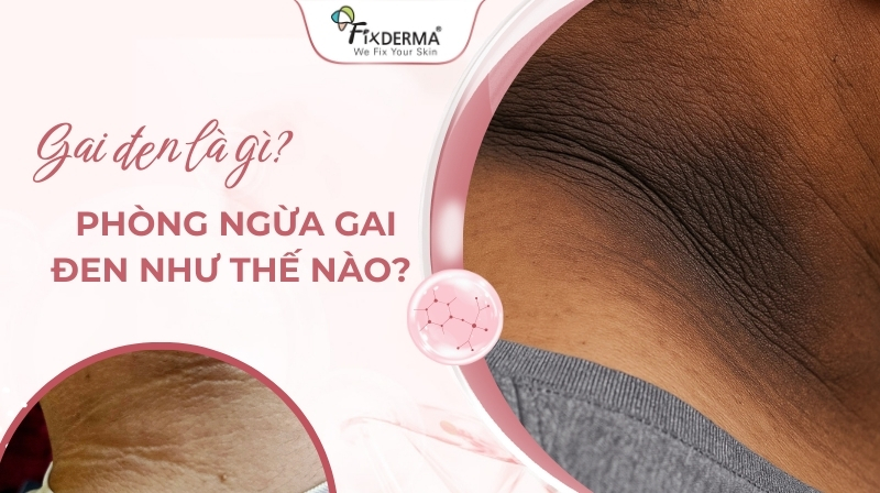 gai đen là gì