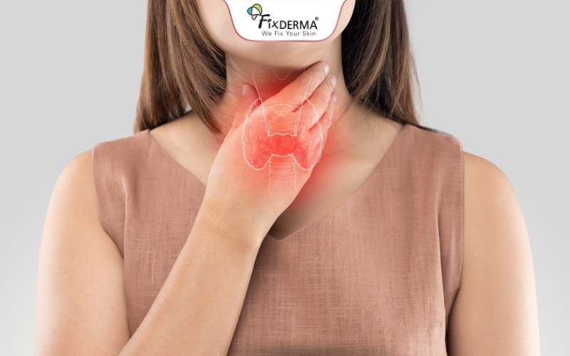 Bệnh lý liên quan đến nội tiết có khả năng mắc gai đen