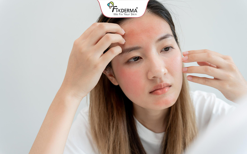 Kem chống nắng chứa thành phần không “thân thiện” có thể gây kích ứng da