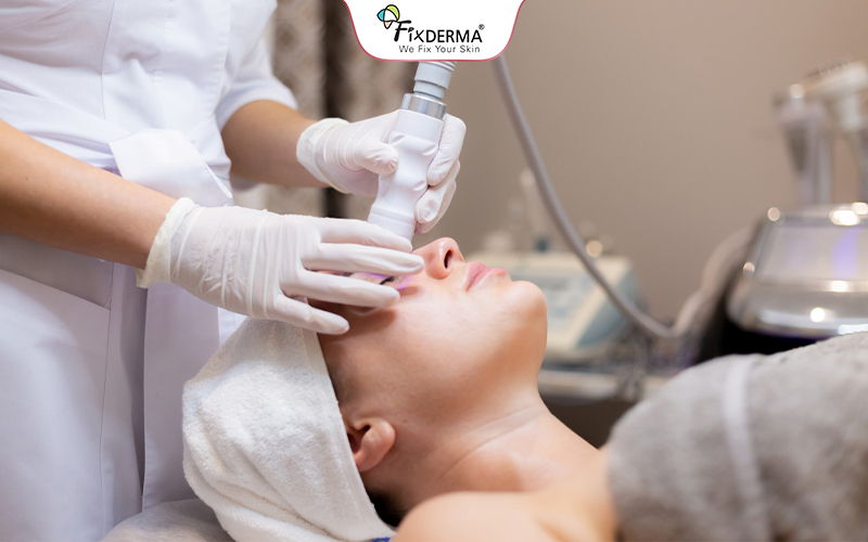 Điều trị mụn bọc với công nghệ cao