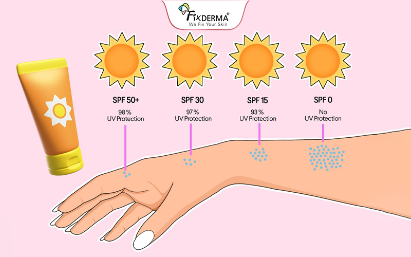 Chọn chỉ số SPF phù hợp