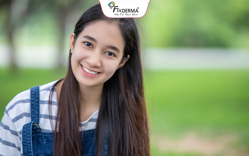 Tuổi 14 thường gặp nhiều vấn đề về da do thay đổi nội tiết tố