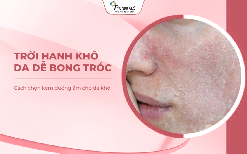 Cách chọn kem dưỡng ẩm cho da khô