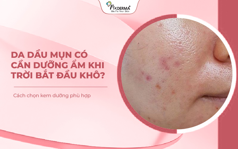 Da dầu mụn có cần dưỡng ẩm khi trời bắt đầu khô? Cách chọn kem dưỡng phù hợp