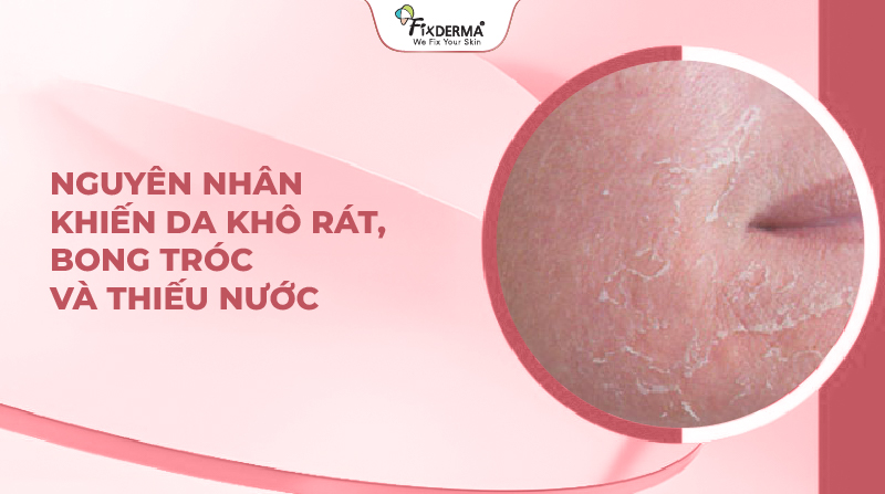 Nguyên nhân khiến da khô rát, bong tróc và thiếu nước