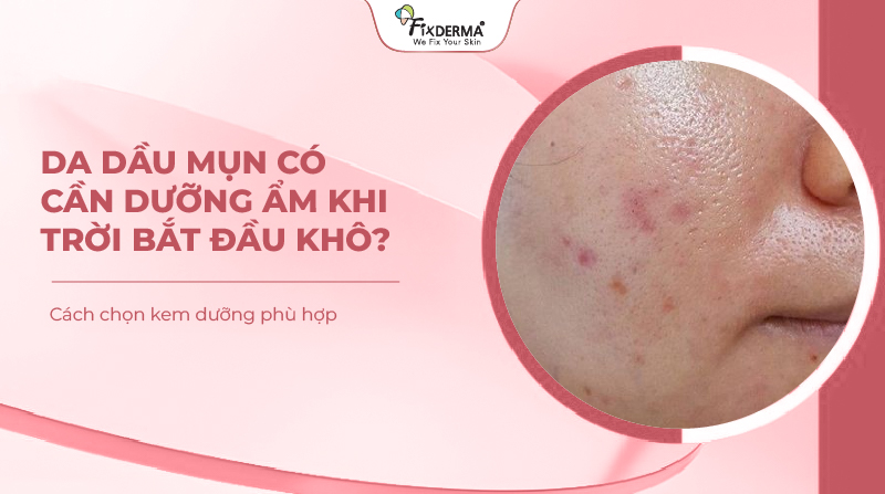 Da dầu mụn có cần dưỡng ẩm khi trời bắt đầu khô? Cách chọn kem dưỡng phù hợp