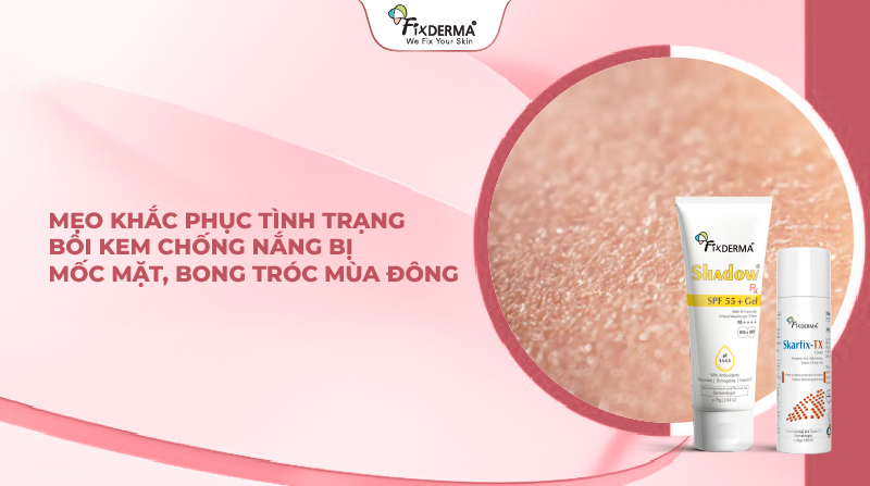 Cảnh báo: 5 tác hại lên làn da nếu bạn bỏ bôi kem chống nắng mùa đông